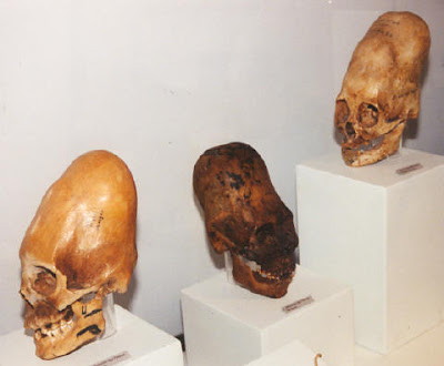 Cráneos hallados con dolicocefalia y braquicefalia