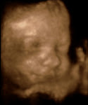 Pippa in utero