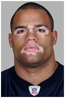 J.D. Runnels-NFL Running Back  Living with Vitiligo