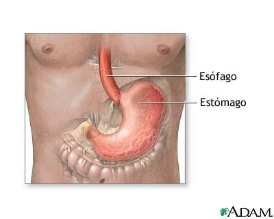 GASTRITIS DEFINICION gastritis definicion: