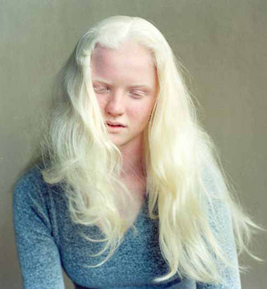 http://2.bp.blogspot.com/_7mkGmo_XHFQ/TL0BUDVQ4AI/AAAAAAAAAxk/aamFBeVG_mg/s1600/albinismo.jpg