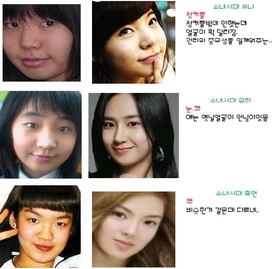  of Girls' Generation, before) asian before and after plastic surgery