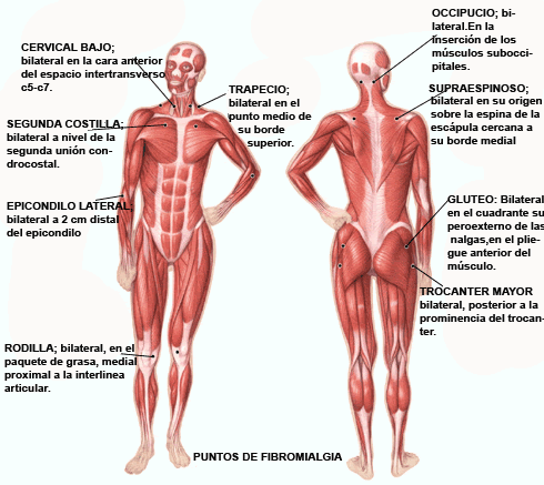 [PUNTOS_FIBROMIALGIA.gif]