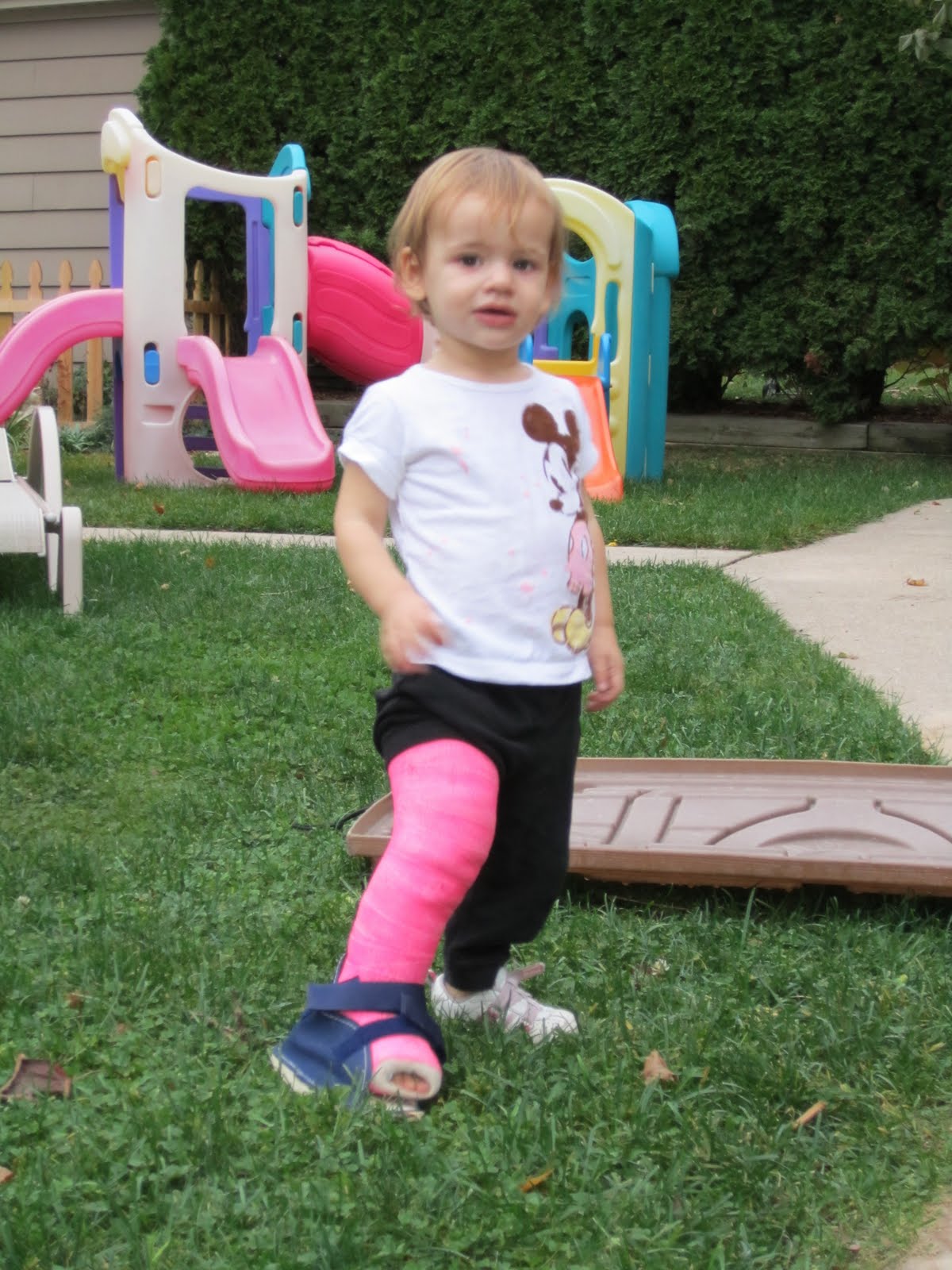 Her+Full+Leg+Cast similar results her full leg cast http hungrybruno blogspot com 2011 ...