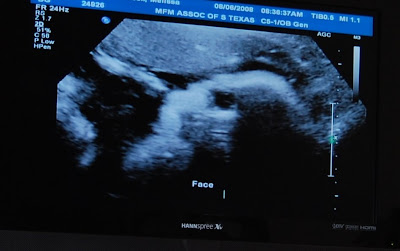 Hair On Ultrasound