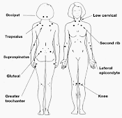 fibromyalgia tender spots diagram chronic and ramblings fibromyalgia tender spots diagram chronic and ramblings