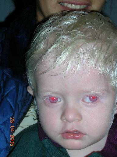 Ojos Ojos