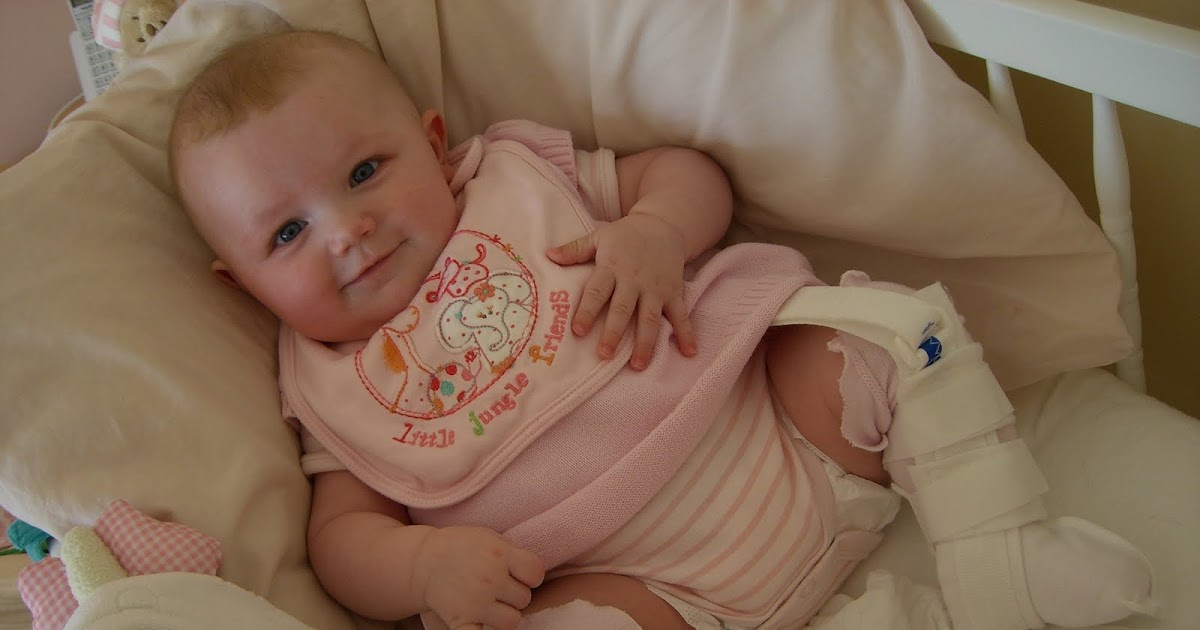 Mummy, I Want it NOW! Baby Hip Dysplasia (clicky hips)