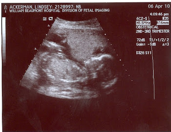 Baby Ackerman