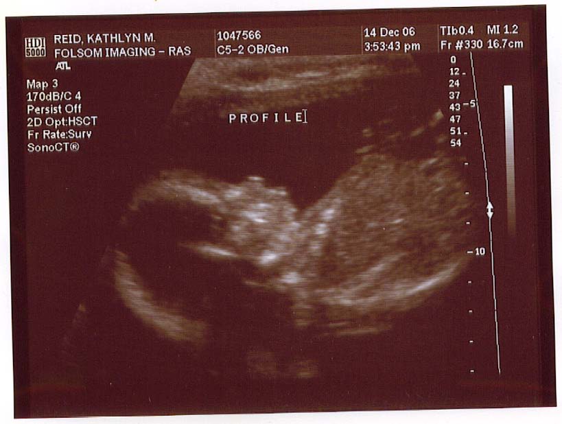 [Baby1]