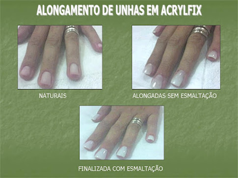 Alongamento de Unhas