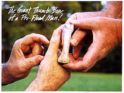 [GiantThumbBone.jpg]