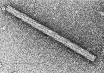 tobacco mosaic virus from