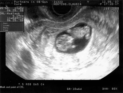 three weeks she has almost ultrasounds at 8 weeks. three weeks she has almost