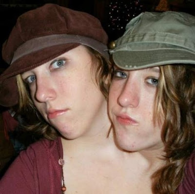conjoined twins abby brittany conjoined twins abby and brittany. conjoined twins abby brittany