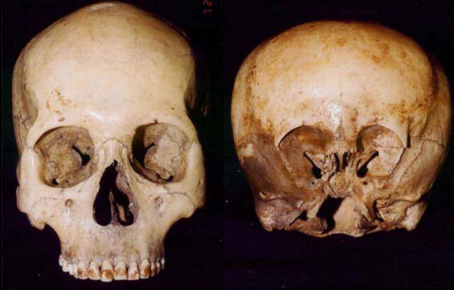 [starchild_skull.jpg]