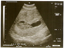 my first picture