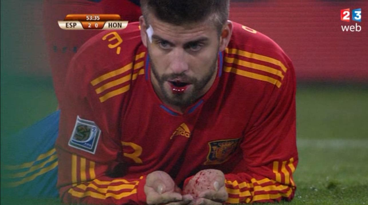 Gerard Pique Bleeding