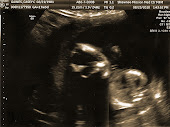 17 weeks - baby's face