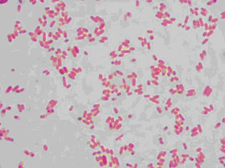 klebsiella pneumoniae gram stain