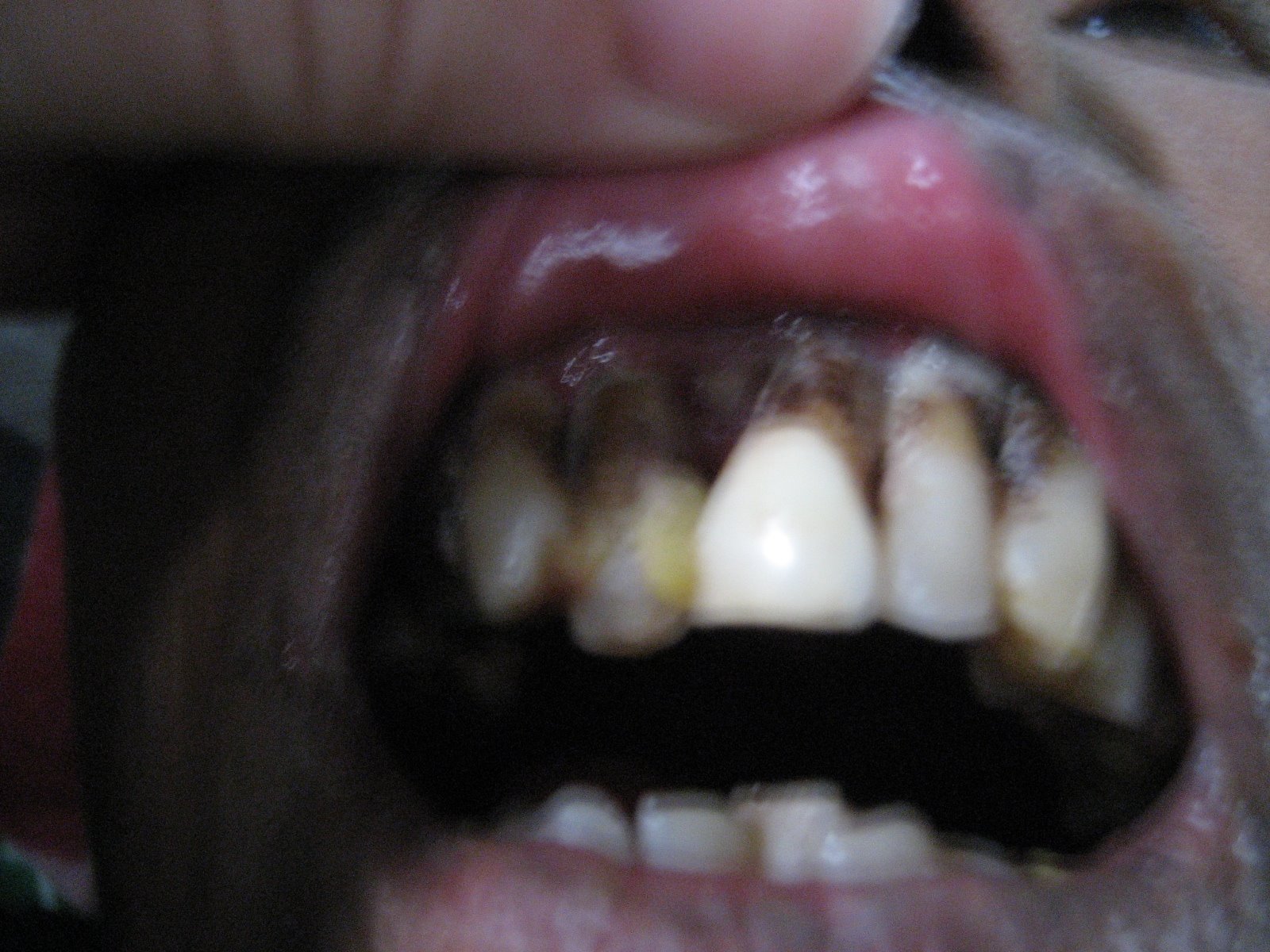 [teeth+3.JPG]