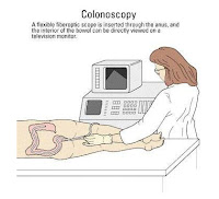 Colonoscopy Procedure Accuracy
