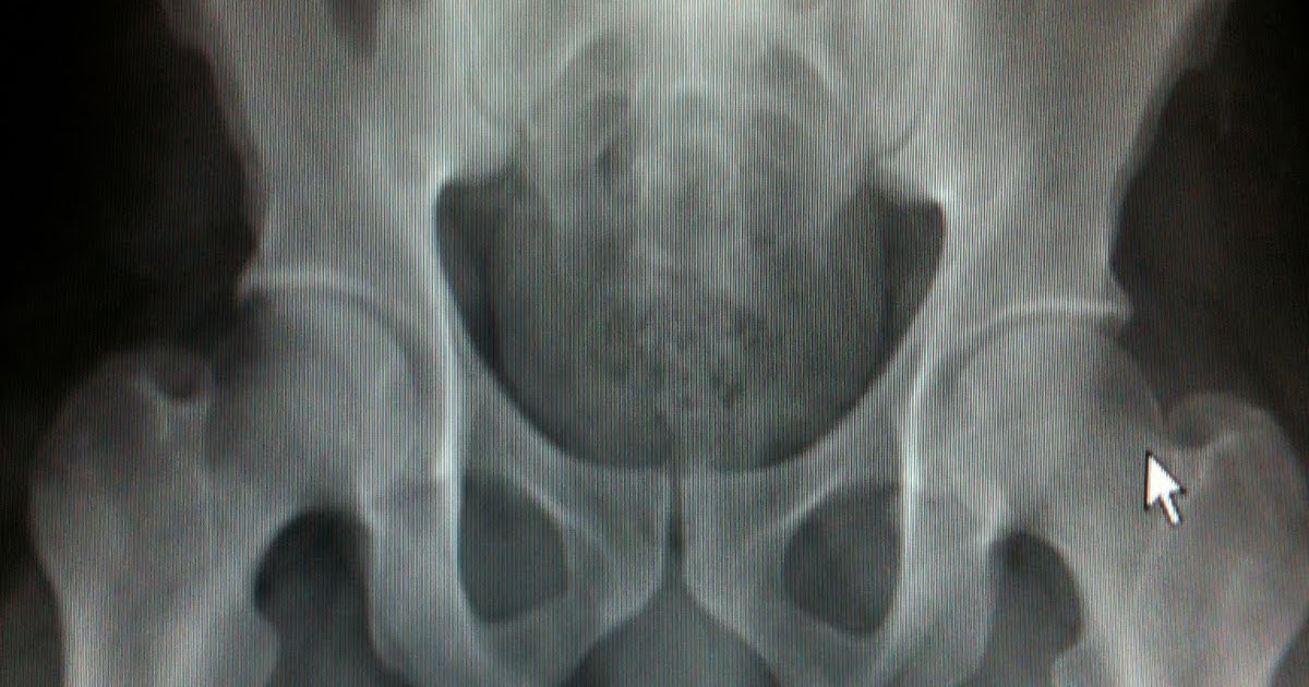 TALES FROM THE SERENITY NOW HOSPITAL Depressed with this Throckmorton