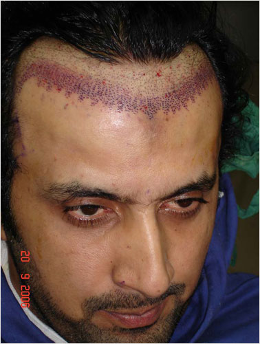 ASAD (T.V ACTOR BEFORE SURGERY)