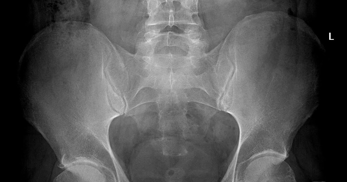 Radiology Cases Cam FAI