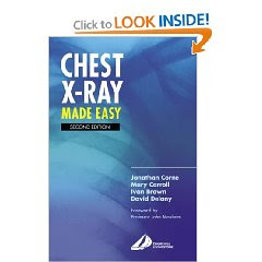 Chest X Rays Made Easy 41A3DYTK8QL