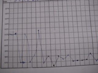 Fever Curve