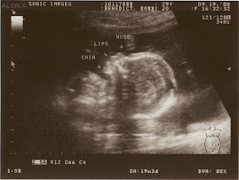 Geoffrey ultrasound