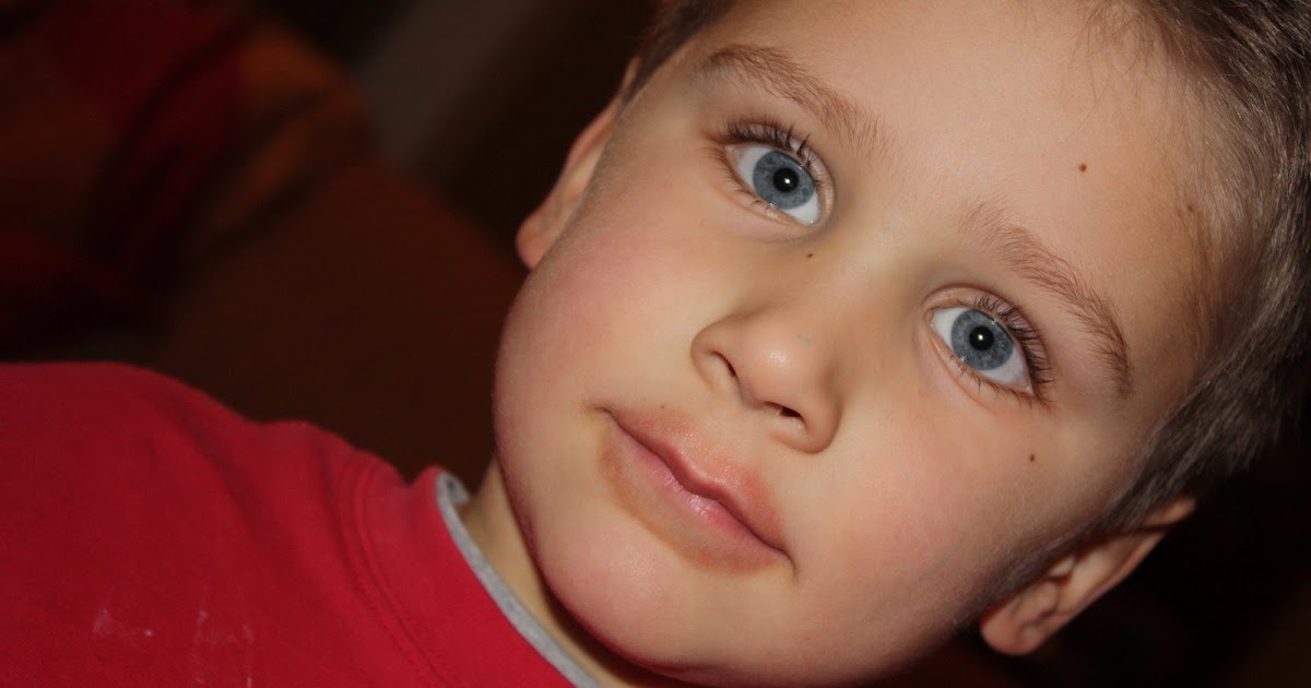 And Lily Makes Three Chapped lips