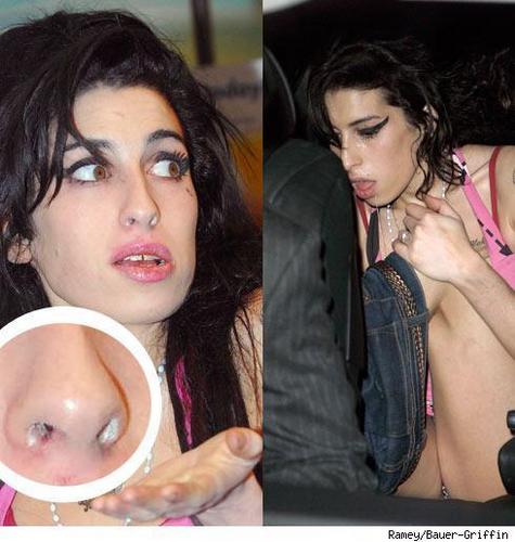 Amy Winehouse Before And After