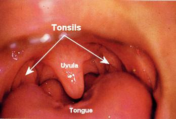 نظرة شاملة عن الجهاز المناعي.. Normal+Tonsils+Labeled