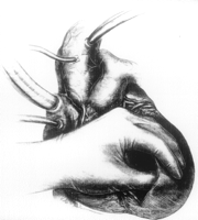 Prognosis is a definite