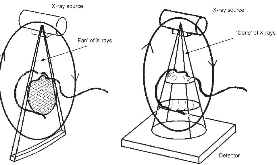 The King is gone Carm Conebeam CT
