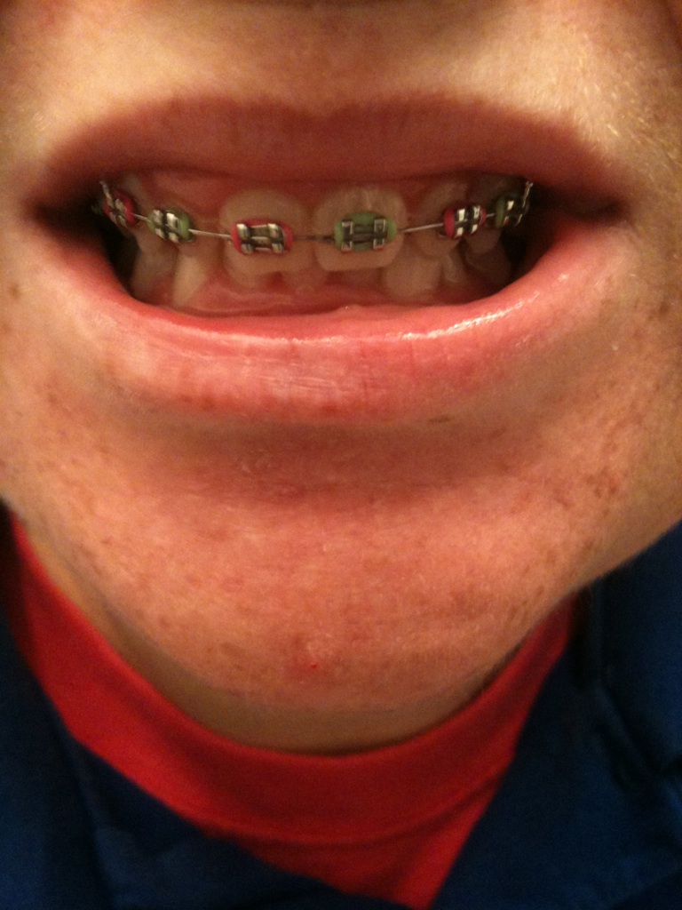 brace yourself owwweeee