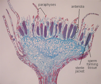 Polytrichum (Male Antheridia)