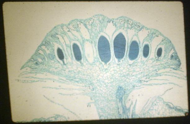 Marchantia (Male Antheridia)