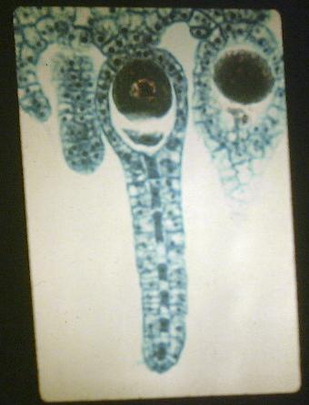 Marchantia (Archegonia)