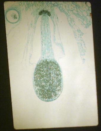 Marchantia (Sporophyte)