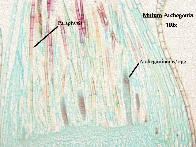 Polytrichum Archegonia 2
