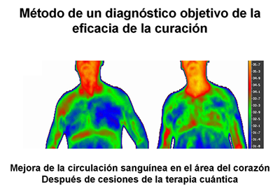 La eccema orlada a los hombres