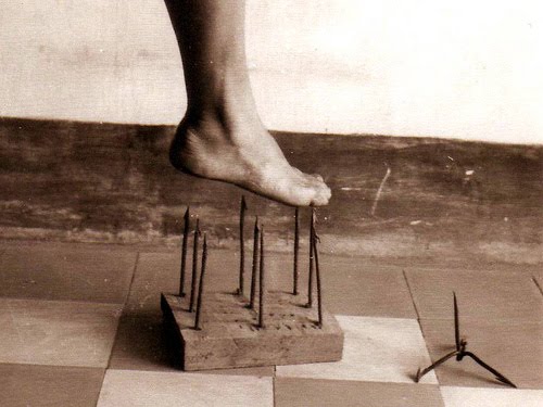 congenital analgesia