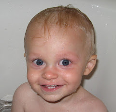 Jack - 1 year, 2 months