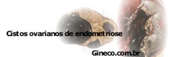 [endometriose_ovariana.jpg]