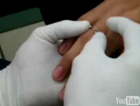 finger piercings pictures. Finger Piercings Anyone?