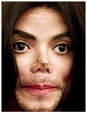 pug nose rhinoplasty pug nose rhinoplasty