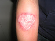 Enviar por correo electrónicoEscribe un blogCompartir con TwitterCompartir .